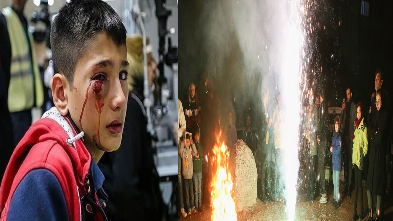 ۷۱۴ مصدوم و ۸۰ قطع عضو در کشور
